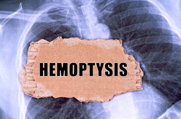 On the X-ray there is a piece of cardboard with the inscription - hemoptysis - Powered by Adobe