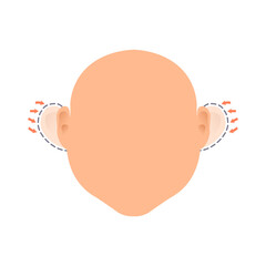 Cosmetic facial plastic ear surgery. Before and after otoplasty surgical correction procedure. Pinnaplasty ear pinning reshaping design template. Faceless portrait. Medical vector illustration.