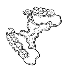 vector doodle illustration of clasp prosthesis. hand drawing of a partial removable denture. dentistry and prosthetics. teeth. orthodontic treatment