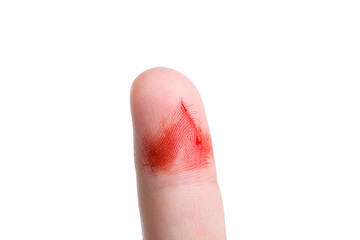 forefinger in streaks of blood with a cut a consequence of skin damage and open bleeding from a scratch on the body close-up isolated on a white background.