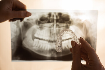 Female hands with transparent mouth guards for correcting bite and x-ray of the jaw. The orthodontist holds the equipment of the orthodontist