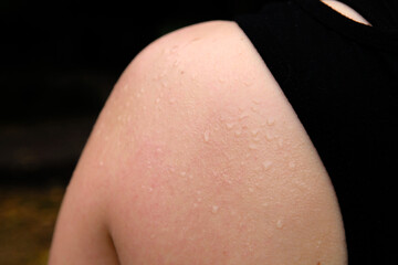 Close up of a girl's shoulder with perspiration.