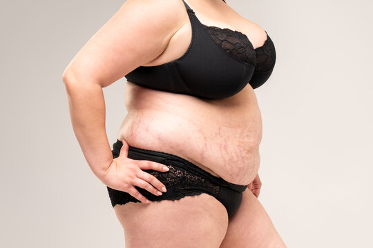 Fat woman in black lingerie, overweight female body with stretch marks on gray background