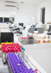 Empty laboratory with microscopes and samples of human fluids in test tubes