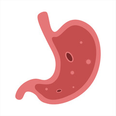 Obraz premium Stomach ulcer, bacteria. Vector flat cartoon illustration on white background