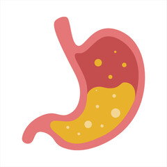 Heartburn and acidity of the stomach. Vector flat cartoon illustration on white background