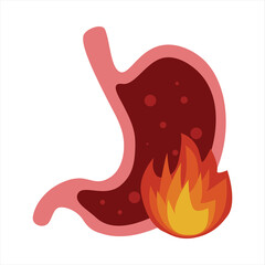 Obraz premium Gastritis of the stomach. Vector flat cartoon illustration on white background