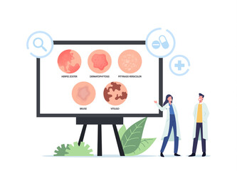 Tiny Doctors Characters Presenting Infographics of Skin Diseases Herpes Zoster, Dermatophytosis, Pityriasis Versicolor
