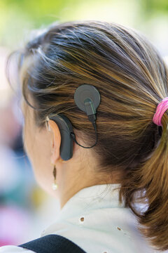 Woman head with cochleral implant hearing aid.