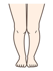 XO脚、膝の病気の解説用イラスト