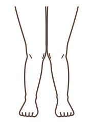 X脚、膝の病気の解説用イラスト