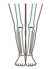 正常な足　脚、膝の病気の解説用イラスト　