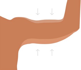 lose arm fat, lose weight