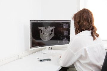 female dentist sits and looks at the x-ray image of the tooth in the computer. A woman doctor...