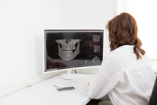 female dentist sits and looks at the x-ray image of the tooth in the computer. A woman doctor examining a patient's tooth with a panoramic radiograph. Diagnostics.