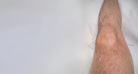 Acupunture needles over caucasian male man knee