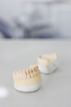 Plaster jaw casts on table in clinic