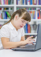 Smart Young girl with syndrome down uses a laptop at library. Education for disabled children...