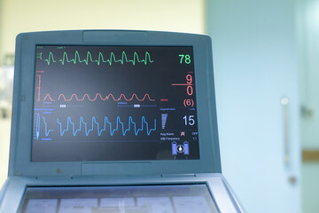 EKG monitor in intra aortic balloon pump machine. Medical equipment.	