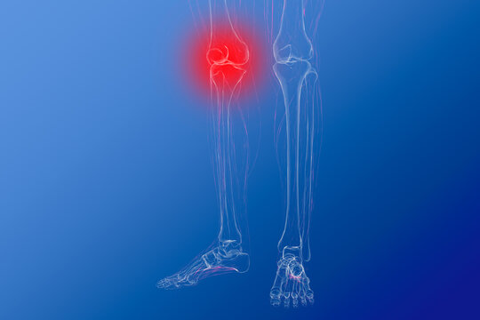 Niederknien Bilder Durchsuchen 814 Archivfotos, und