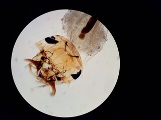 Mosquito larvae under a microscope