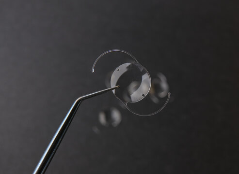 closeup photo of elastic intra ocular lens for cataract surgery