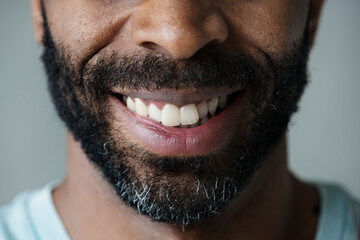 Obraz premium Closeup of smiling teeth of a black man