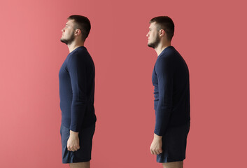 Young man with bad and proper posture on color background - obrazy, fototapety, plakaty