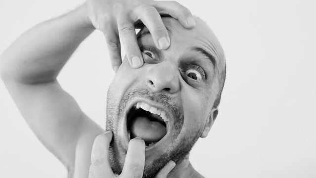 Man with schizophrenia suffering from dementia, time lapse of mad man with mental disorder, psychedelic black and white video clip