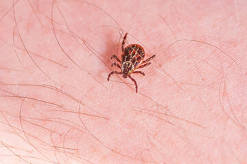 Mite on the skin. Danger of tick bite.