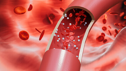 Red blood cells and white blood cells flow through the large blood vessels. State of vascular circulation. 3d render.
