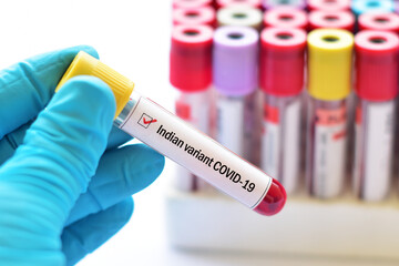 Obraz premium Indian variant COVID-19, blood sample tube positive with Indian strain COVID-19 virus 