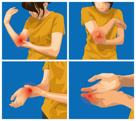 Pain and injuries in body parts. woman is feeling pain in elbow, wrist and finger. 