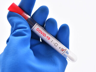 Obraz premium Nasopharyngeal swab positive with COVID-19 test by using RT-PCR method 