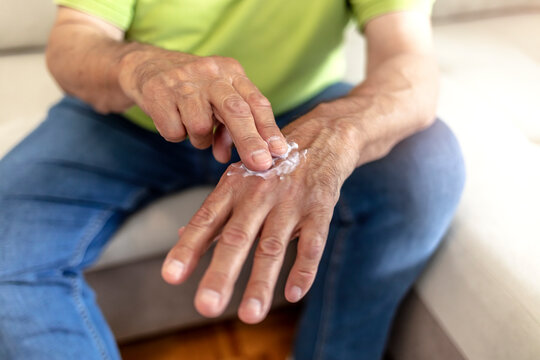 An older man using hand cream against varicose veins. Men's hand using moisturizing cream, skin and hand care. Close up view of mature male hands moisturizing his hands with cream. Copy space.