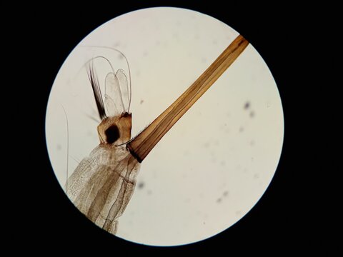 Mosquito larvae segment under a microscope