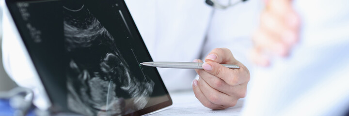 Doctor demonstrates fetal ultrasound on tablet screen