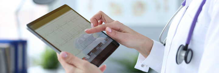 Doctor is holding tablet with heart cardiogram