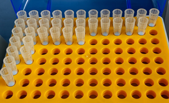 Tips in orange plastic rack for micropipette