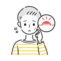 男性　ニキビ　吹き出物