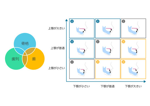 矯正歯科・歯の噛み合わせ表