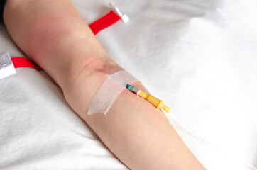 Intravenous drip in the hospital emergency room for first aid