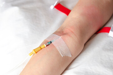 Intravenous drip in the hospital emergency room for first aid