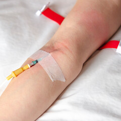 Intravenous drip in the hospital emergency room for first aid