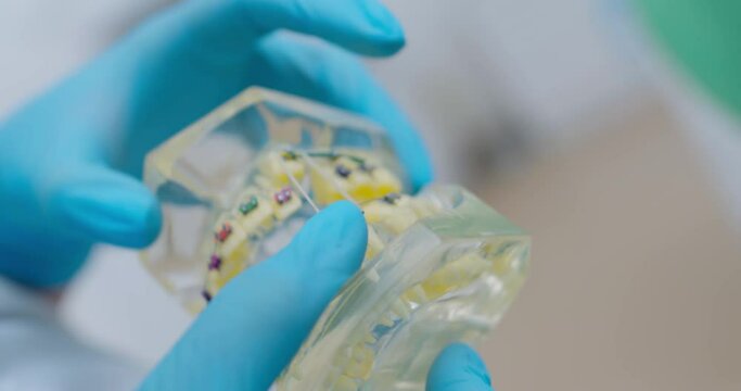 Close-up a model of a human jaw with a bracket system on the ceramic teeth that someone is showing in blue gloves.