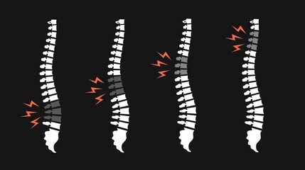 Back pain vector icon illustration isolated on black. Backache spines set. Damaged Disks