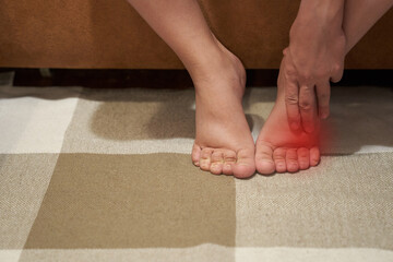 Woman with swelling on the legs, tired and pain in the legs, swelling during pregnancy. High...