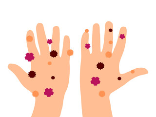Dirty hands illustration. Hands palms full with bacteria and viruses. Cuacasian white ethnicity. Hygiene awarness.