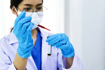 Scientist holding Coronavirus covid-19 infected blood sample tube DNA testing of the blood in the...