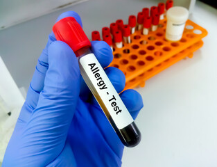 Test tube with blood sample for food allergy test.